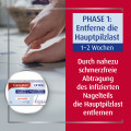 CANESTEN Extra Nagelset Creme 10g + 15 Hygienepflaster zur Behandlung von Nagelpilz