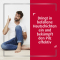 CANESTEN Creme zur Behandlung von Hautpilz und Fußpilz