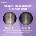REGAINE Frauen Lösung Minoxidil bei anlagebedingtem Haarausfall