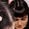 DUCRAY KELUAL DS Anti-Schuppen-Shampoo
