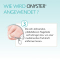 ONYSTER Nagelset