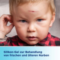 BEPANTHEN Narben-Gel mit Massage-Roller