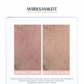 EUCERIN SEH Anti-Rötungen kaschierende Tagespflege