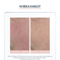 EUCERIN SEH Anti-Rötungen beruhigende Pflege
