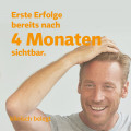 MINOXIDIL BIO-H-TIN® 50mg/ml für Männer