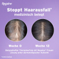REGAINE Frauen Schaum 50 mg/g bei Haarausfall vom weiblichen Typ