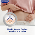 HANSAPLAST Pflaster zur Behandlung von Narben