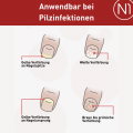 N1 Nagelpilz Lösung