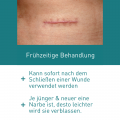 N1 Narben Gel