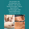 N1 Narben Gel