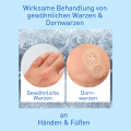 N1 Warzen Vereisungsmittel Spray