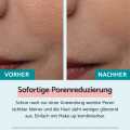 Remescar Große Poren verkleinern mit Soforteffekt, 20ml