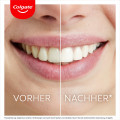 Colgate Max White Ultimate LED Whitening Kit für zu Hause