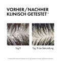 VICHY DERCOS Anti-Schuppen 2in1 ShampooConditioner